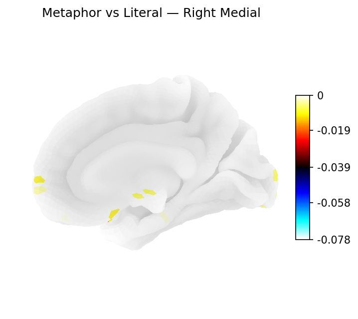 Classifier weights — Right medial